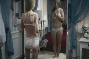 Bulimia versus anorexia!